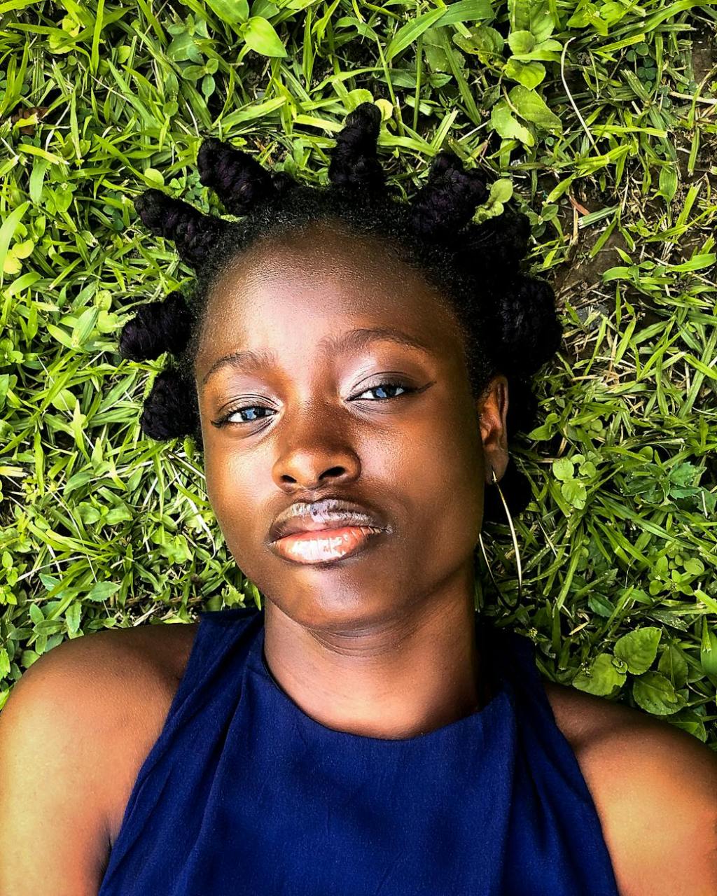 Mon expérience avec la rhinoplastie ethnique pour adolescente : Un nouveau regard sur&nbsp;moi-même